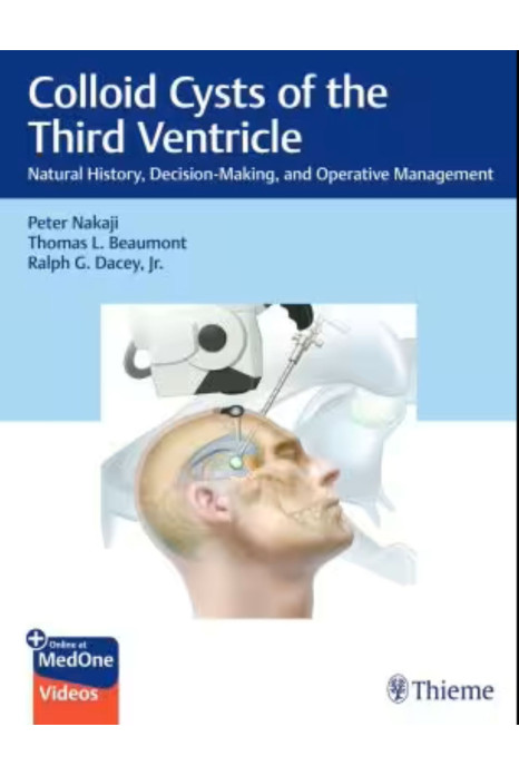 Colloid Cysts Of The Third Ventricle 3Ed (Hb 2024)