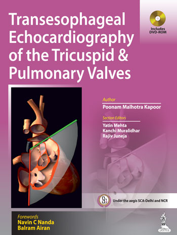 Transesophageal Echocardiography Of The Tricuspid & Pulmonary Valves Includes Dvd-Rom