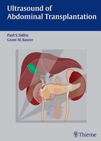 Ultrasound of Abdominal Transplantation