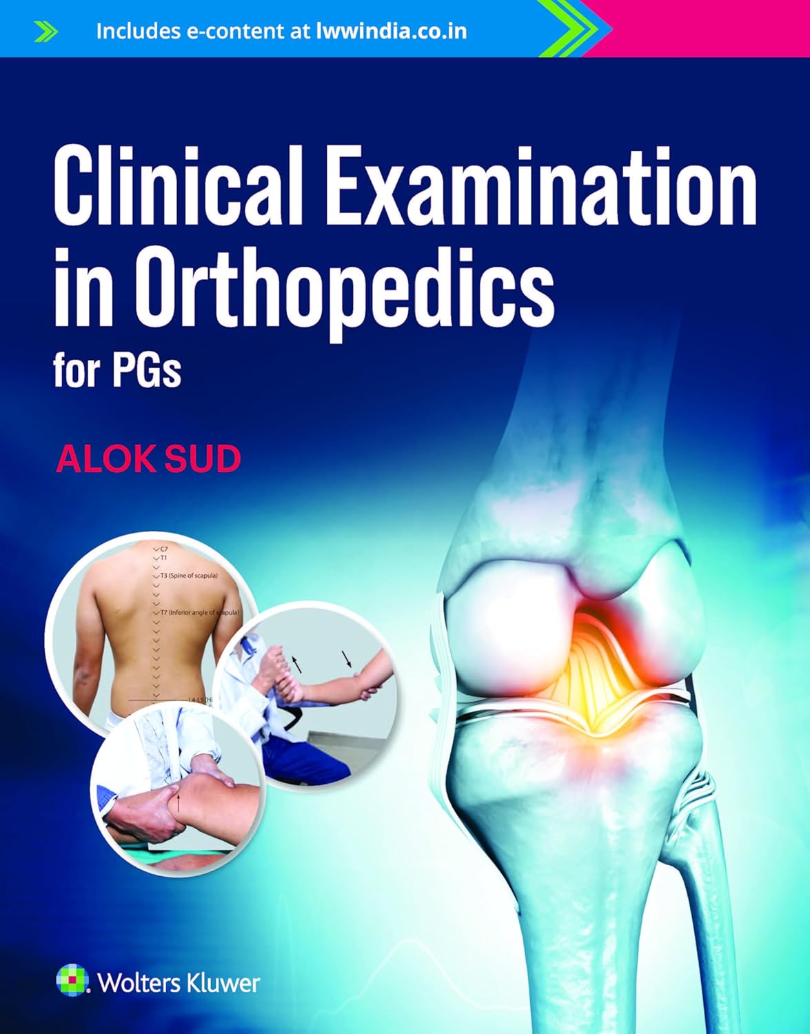 Clinical Examination In Orthopaedics For Pgs (Pb 2023)