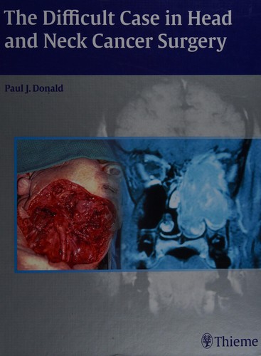 The Difficult Case in Head and Neck Cancer Surgery