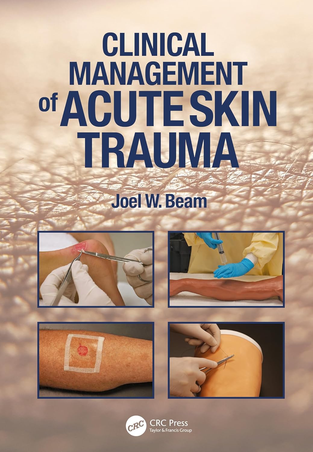 Clinical Management Of Acute Skin Trauma (Pb 2025)