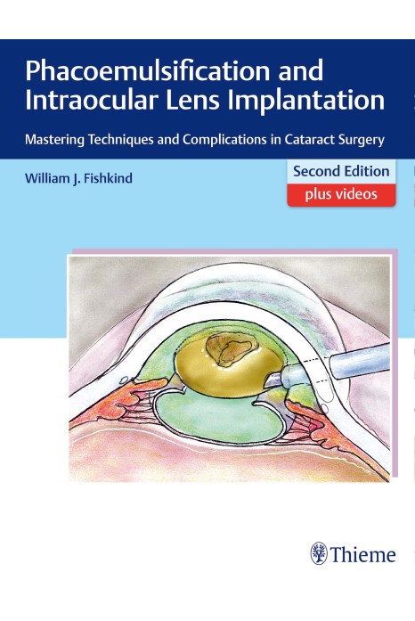Phacoemulsification and Intraocular Lens Implantation 2nd Edition 2019