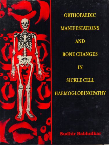 Orthopaedic Manifestations And Bone Changes In Sickle Cell Haemoglobinopathy (1997)