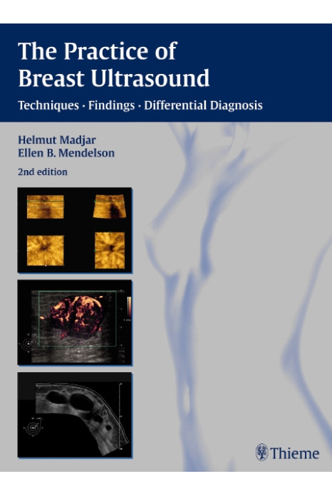 The Practice Of Breast Ultrasound Techniques Findings Differential Diagnosis 2Ed (Hb 2008)