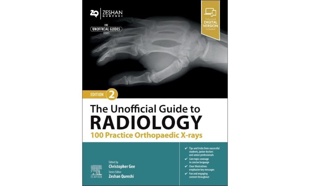 The unofficial guide to radiology 100 practice orthopaedic x rays with access code 2ed (pb 2024)