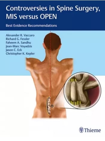 Controversies In Spine Surgery, Mis Versus Open Best Evidence Recommendations
