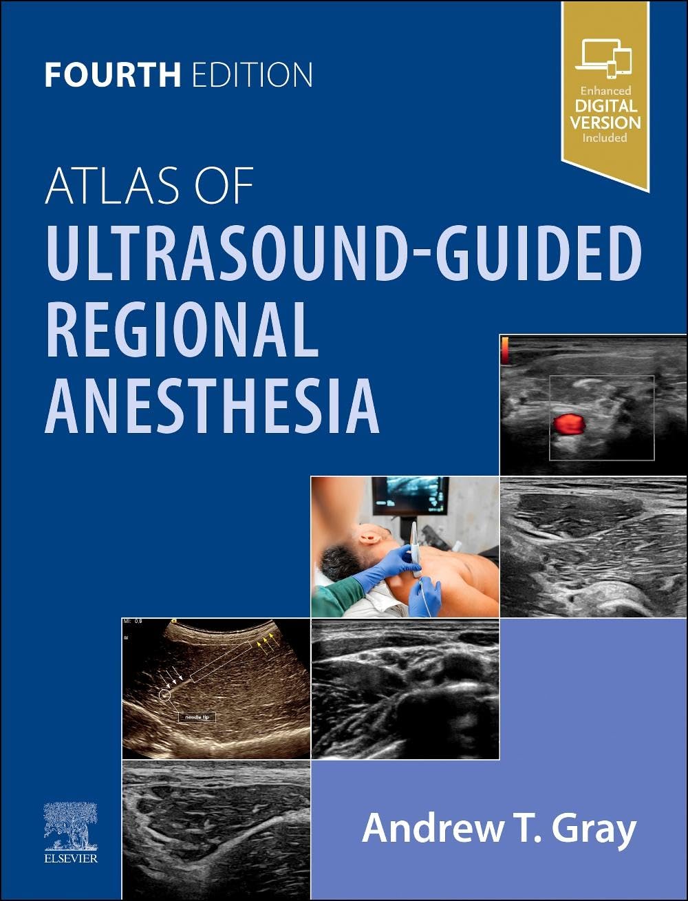 Atlas of ultrasound guided regional anesthesia with access code 4ed (hb 2026)