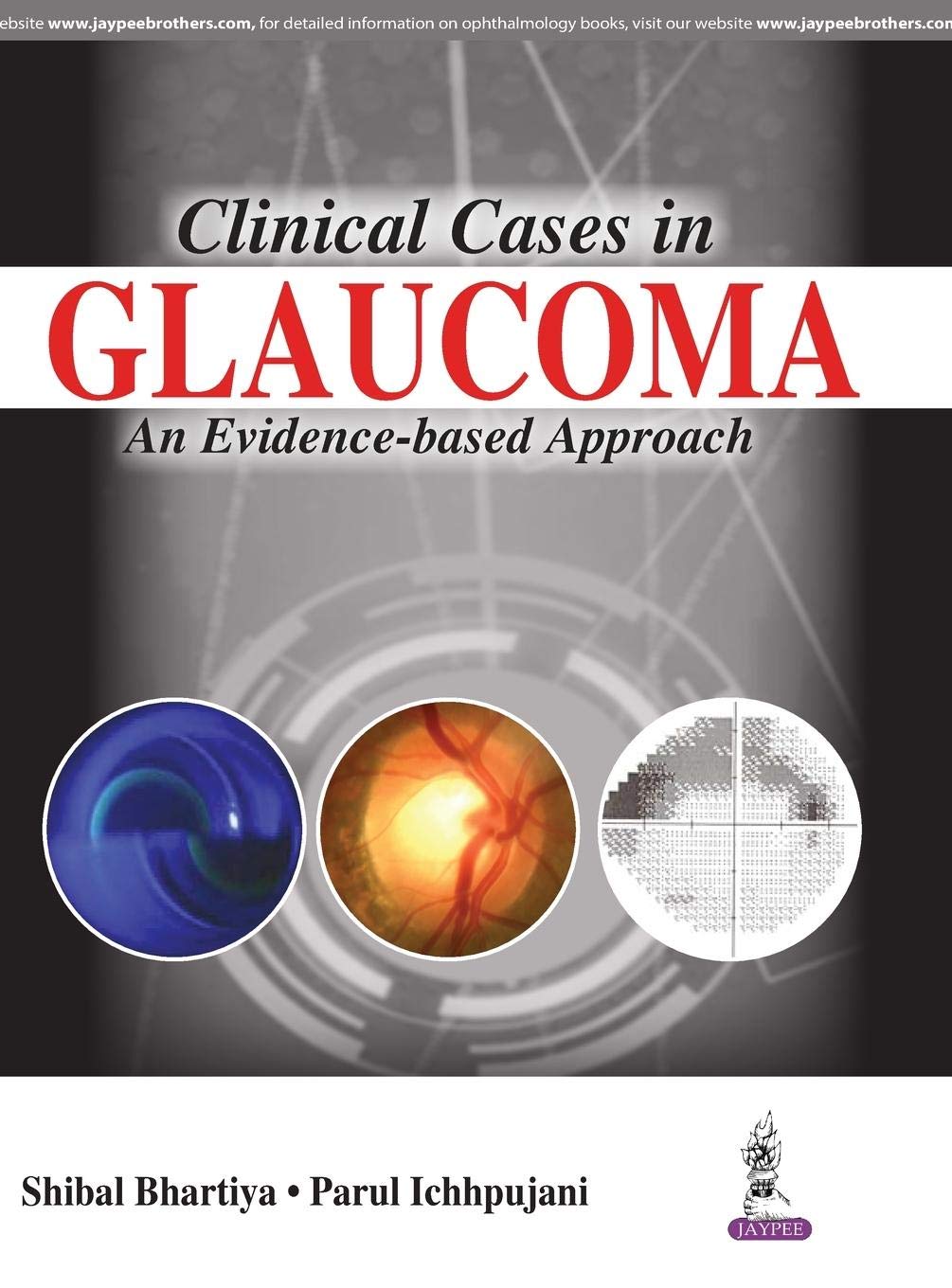 CLINICAL CASES IN GLAUCOMA AN EVIDENCE-BASED APPROACH 1ST EDITION 2017