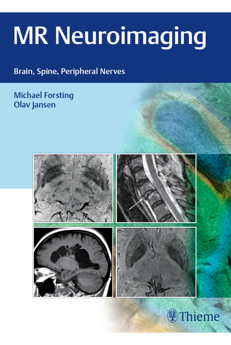 MR Neuroimaging : Brain, Spine, and Peripheral Nerves 1st Edition 2016