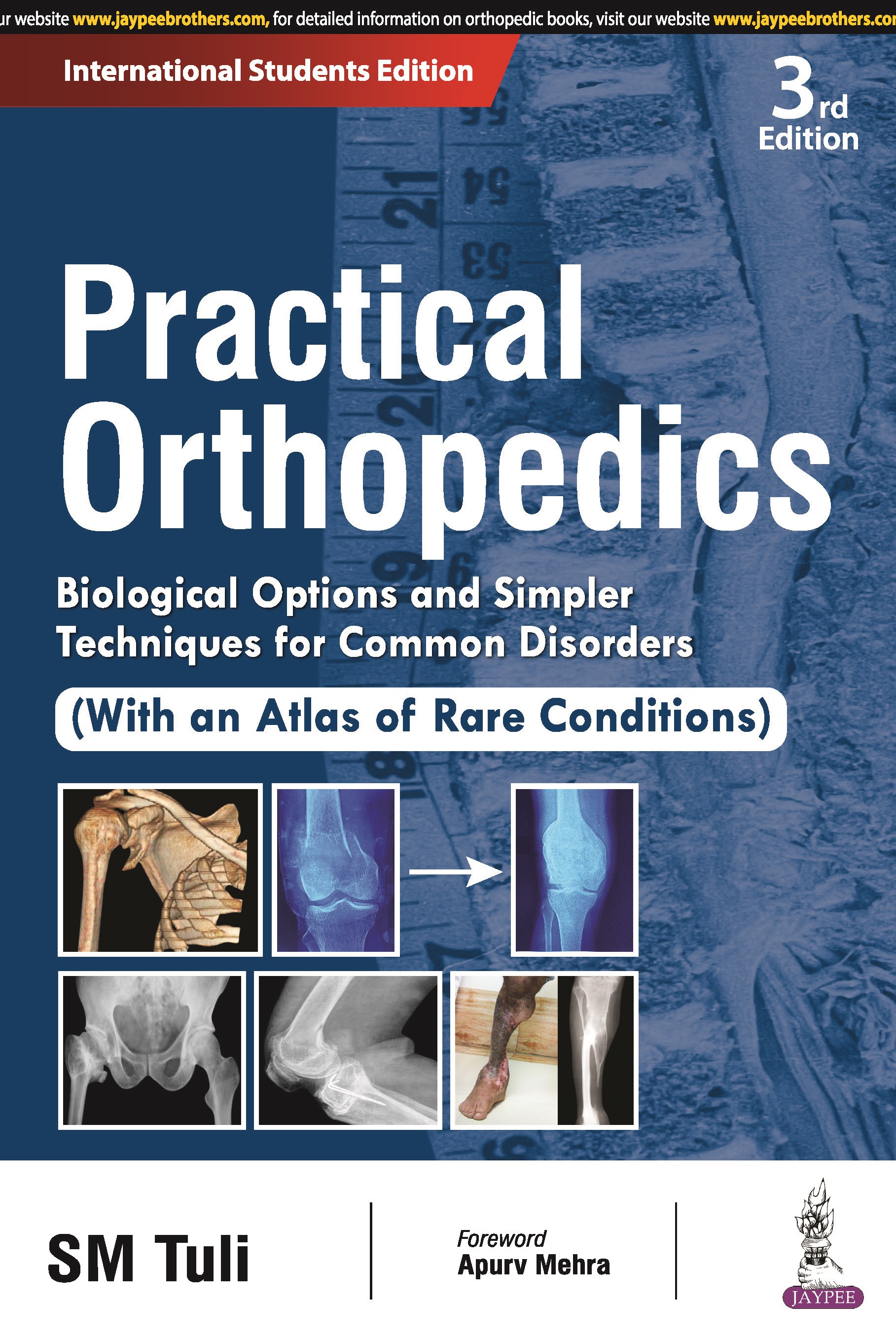 PRACTICAL ORTHOPEDICS: BIOLOGICAL OPTIONS AND SIMPLER TECHNIQUES FOR COMMON DISORDERS (WITH AN ATLAS OF RARE CONDITIONS)