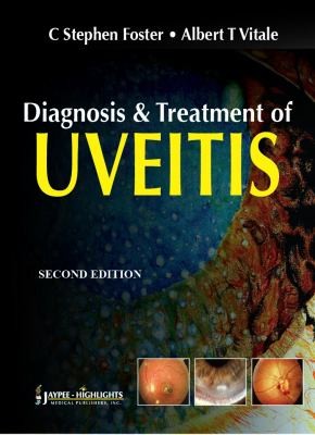 Diagnosis And Treatment Of Uveitis