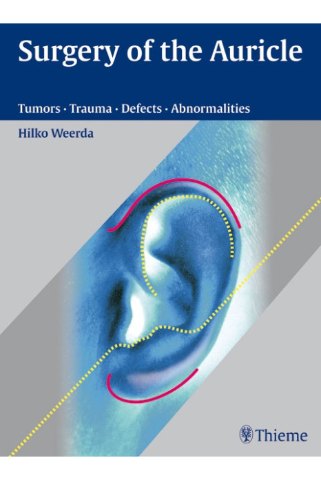 Surgery Of The Auricle Tumors-Trauma-Defects-Abnormalities
