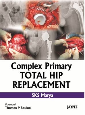 Complex Primary Total Hip Replacement By Sks Marya