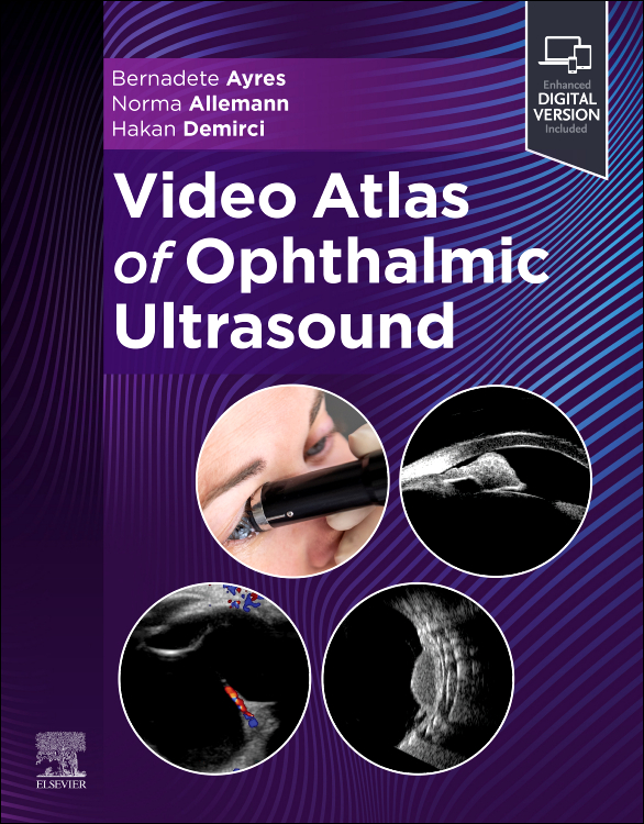 Video atlas of ophthalmic ultrasound with access code (pb 2026)