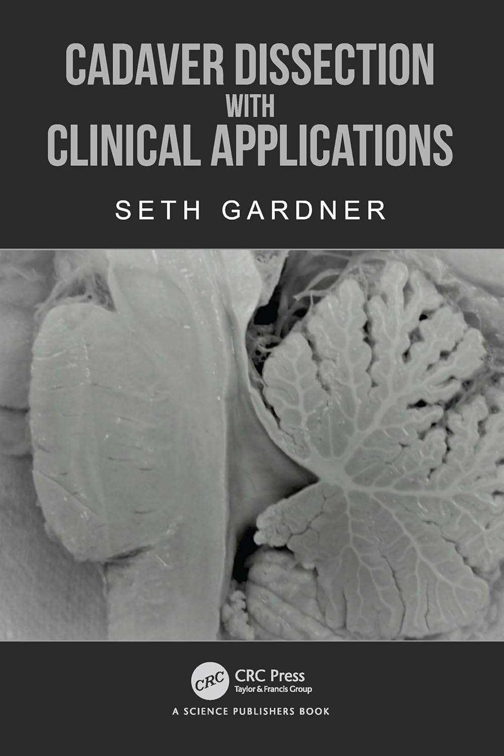 Cadaver Dissection With Clinical Applications (Hb 2024)
