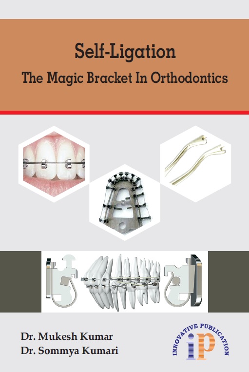 Self-Ligation - The Magic Bracket In Orthodontics