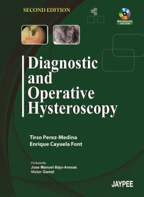 Diagnostic and Operative Hysteroscopy