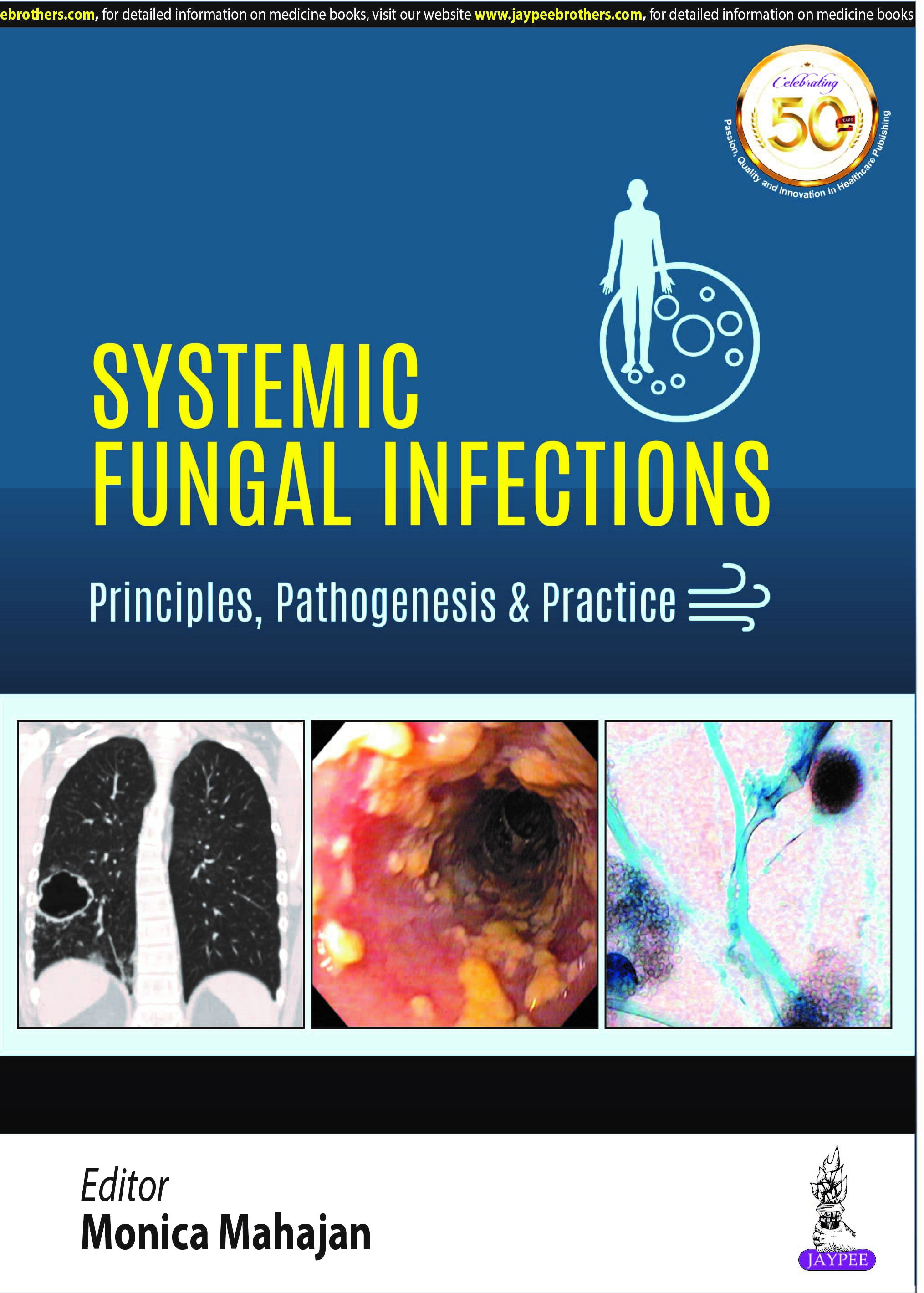 Systemic Fungal Infections: Principles, Pathogenesis & Practice