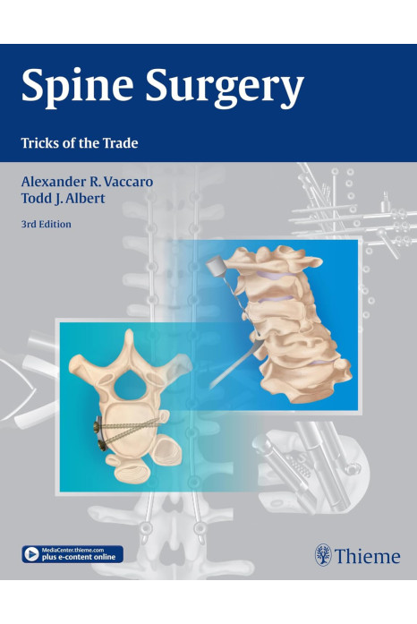 Spine Surgery Tricks Of The Trade