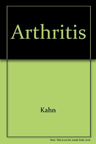 Cover of Arthritis: Causes, Prevention and Treatment