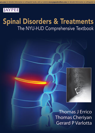 SPINE DISORDERS AND TREATMENTS:THE NYU-HJD COMPREHENSIVE TEXTBOOK