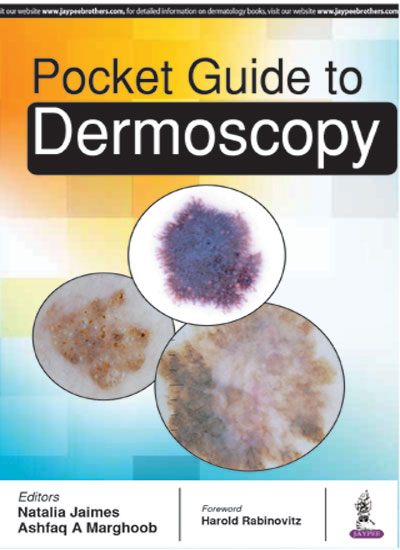 POCKET GUIDE TO DERMOSCOPY