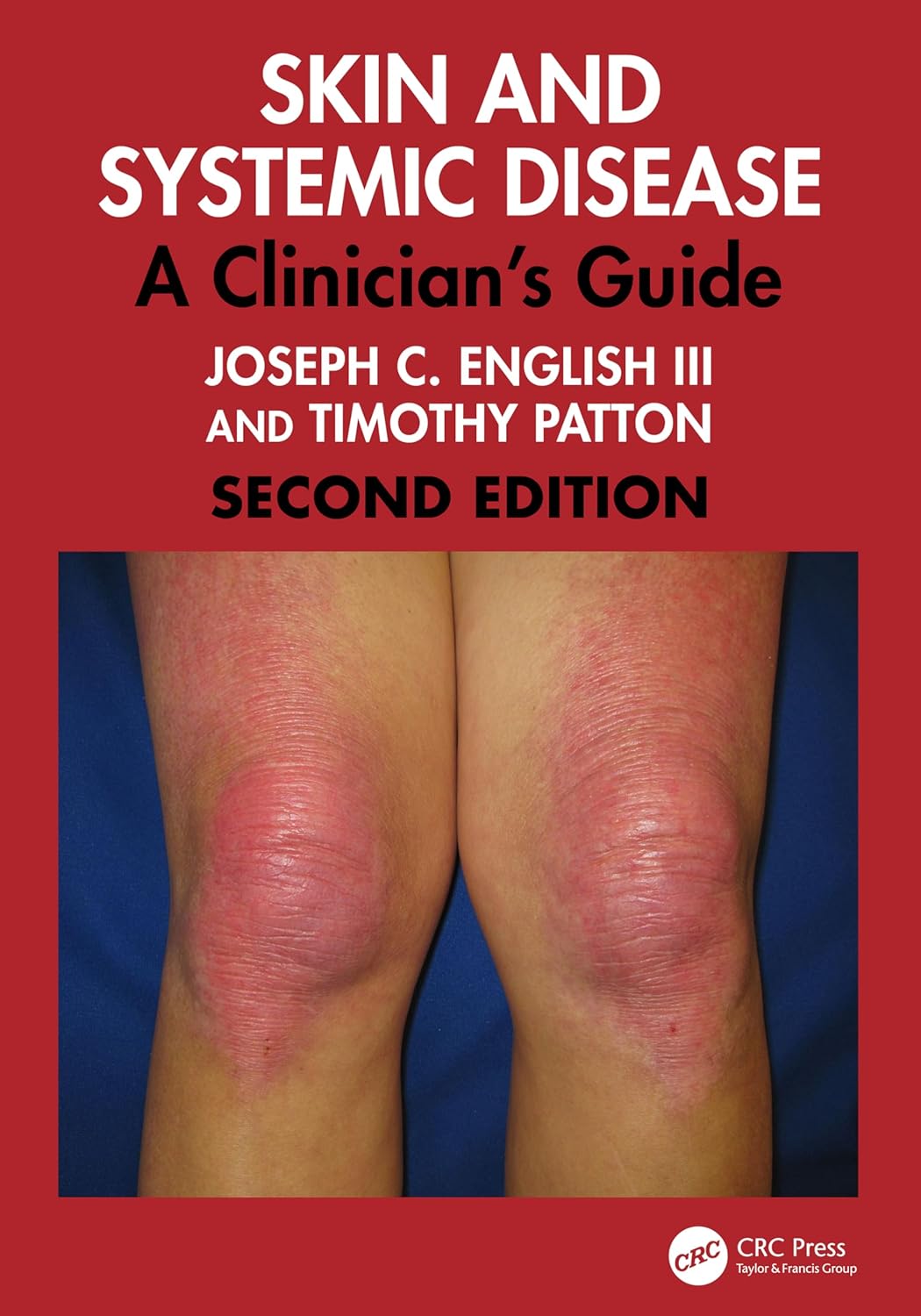 Skin And Systemic Disease A Clinicians Guide 2Ed (Hb 2026)