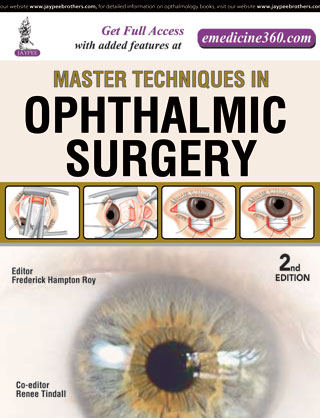 Master Techniques In Ophthalmic Surgery