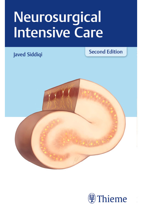 Neurosurgical Intensive Care 2nd Edition 2017