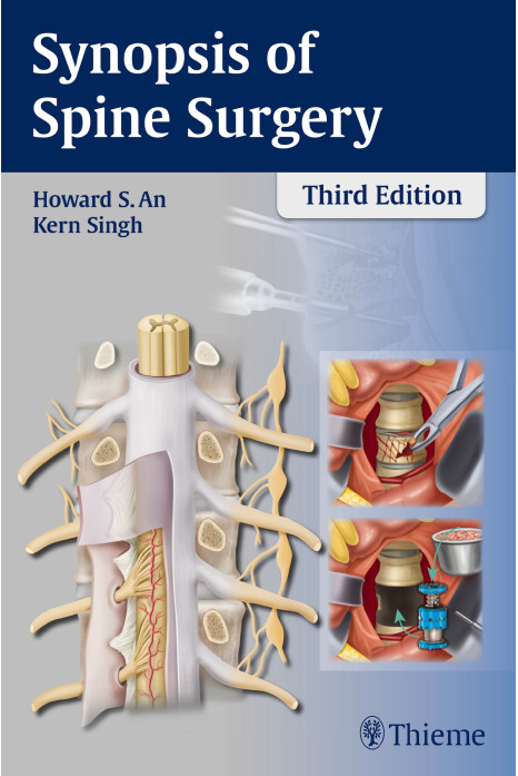 Synopsis of Spine Surgery 3rd Edition 2015