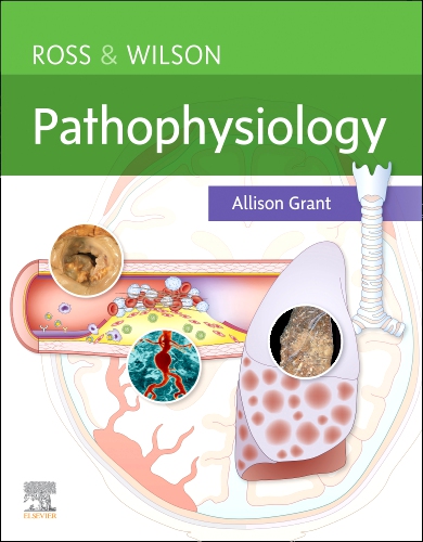 Ross And Wilson Pathophysiology (Pb 2024)