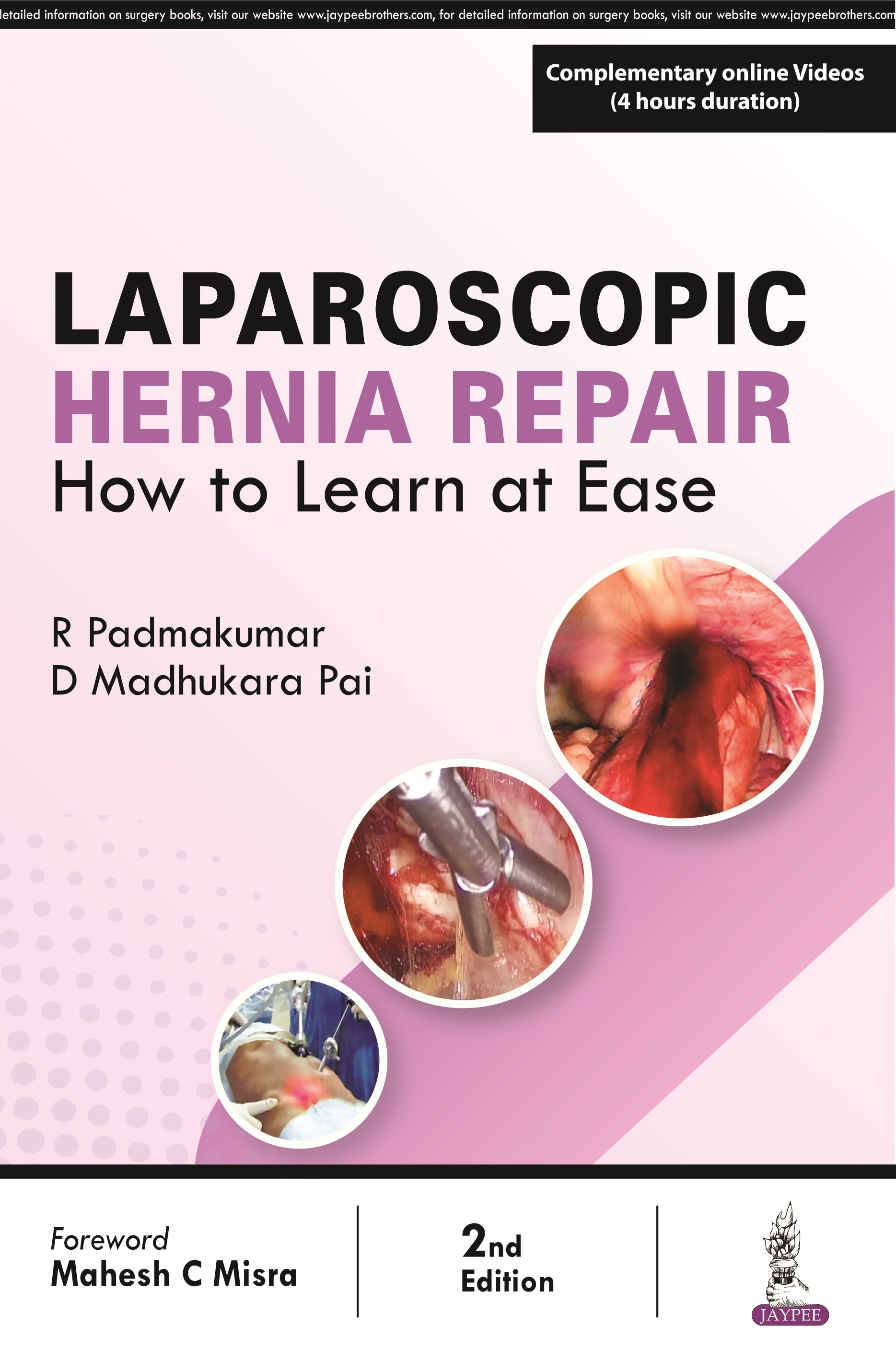 LAPAROSCOPIC HERNIA REPAIR: HOW TO LEARN AT EASE