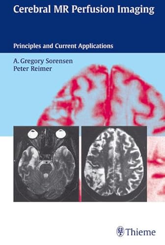 Cerebral MR Perfusion Imaging Book + CD-ROM Set