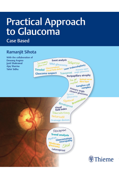 Practical Approach to Glaucoma – Case Based 1st Edition 2021