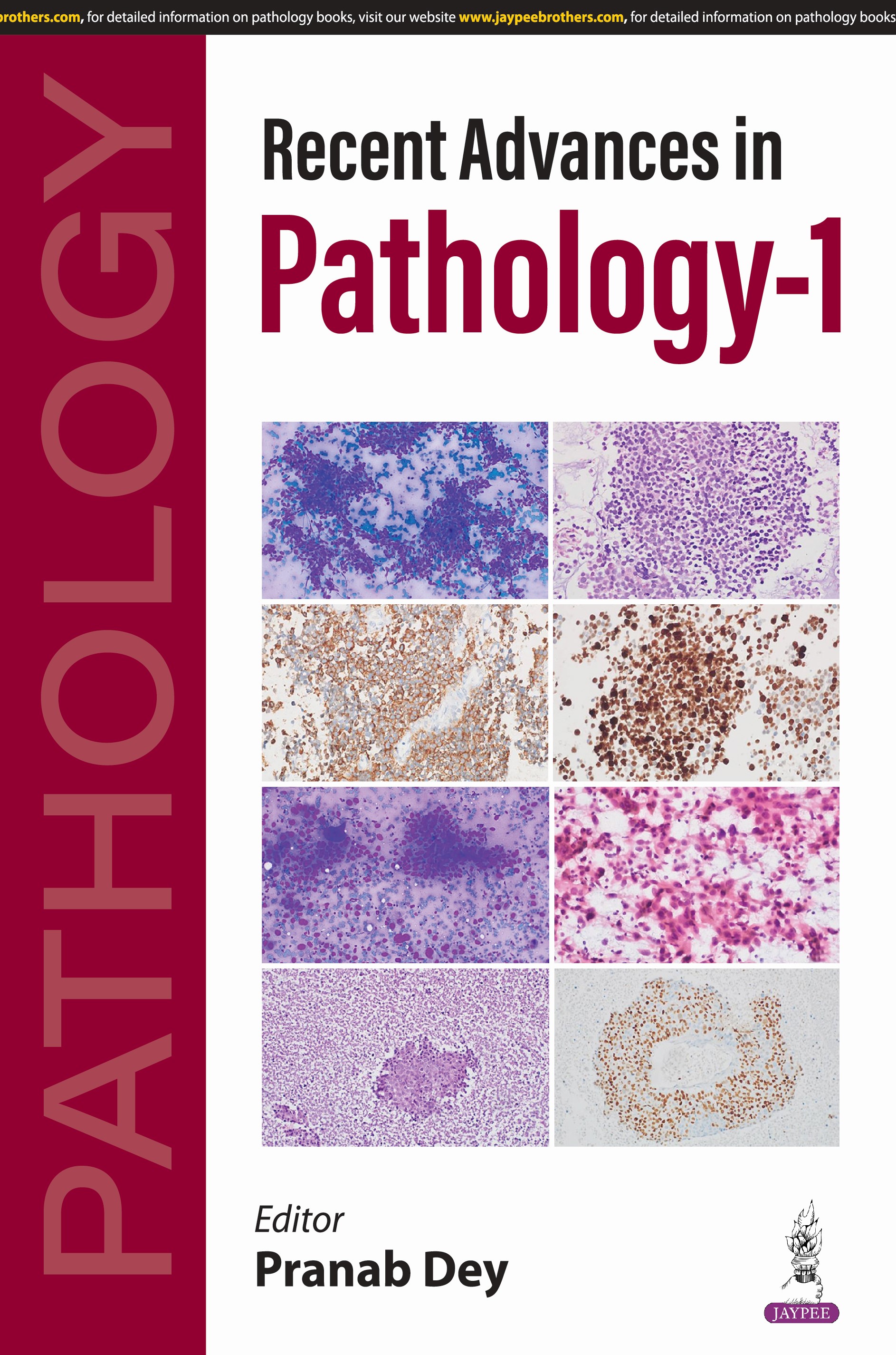 RECENT ADVANCES IN PATHOLOGY-1
