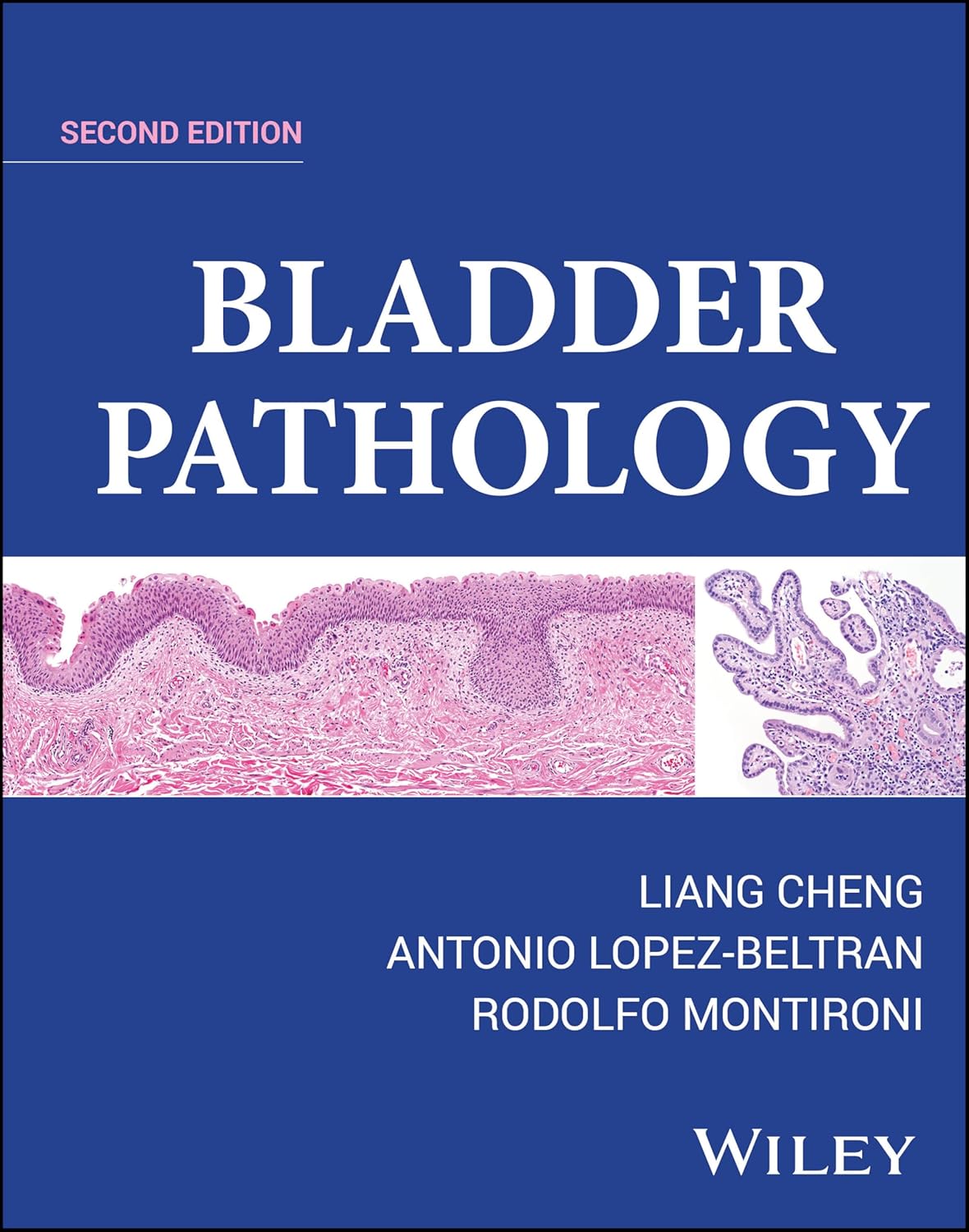 Bladder Pathology 2Ed (Hb 2025)