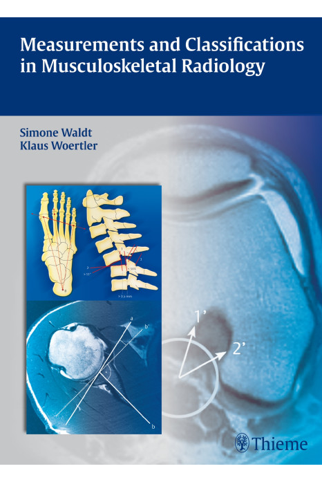 Measurements And Classifications In Musculoskeletal Radiology