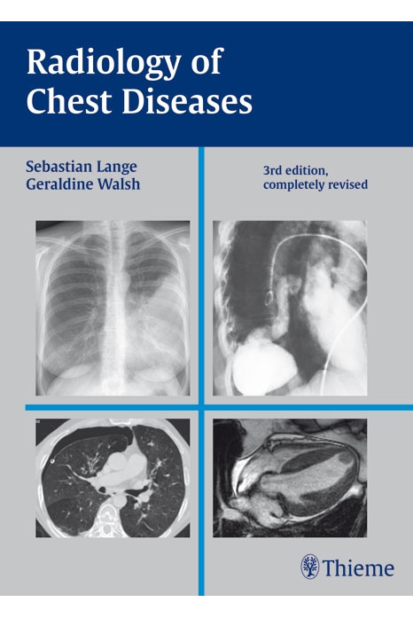 Radiology of Chest Diseases 3rd Edition 2007