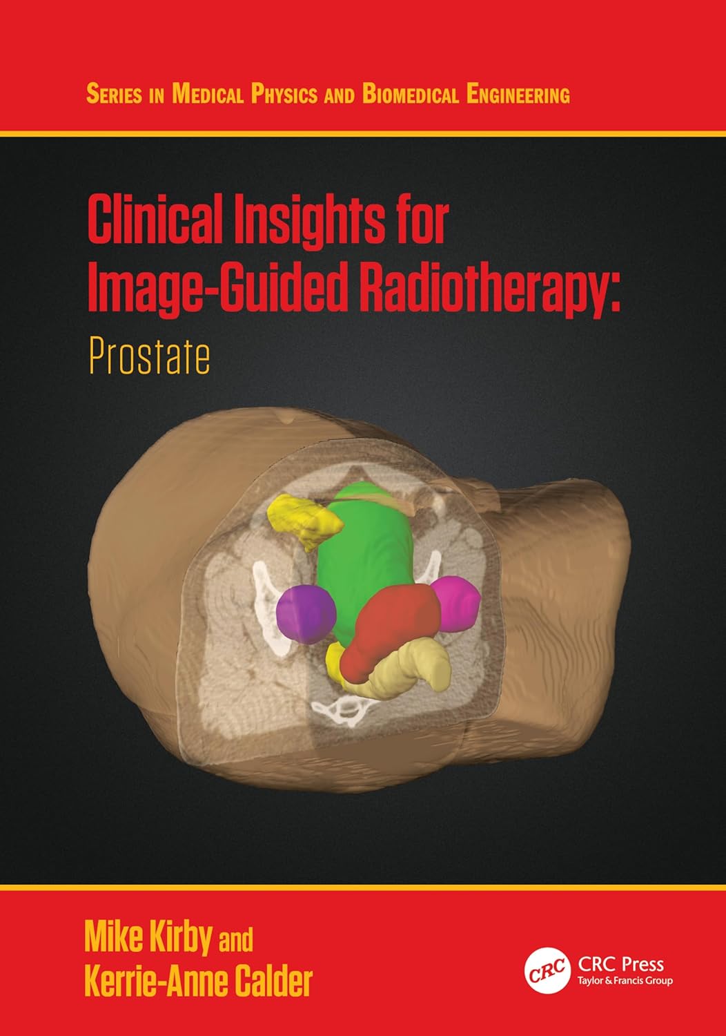 Clinical Insights For Image Guided Radiotherapy (Hb 2024)