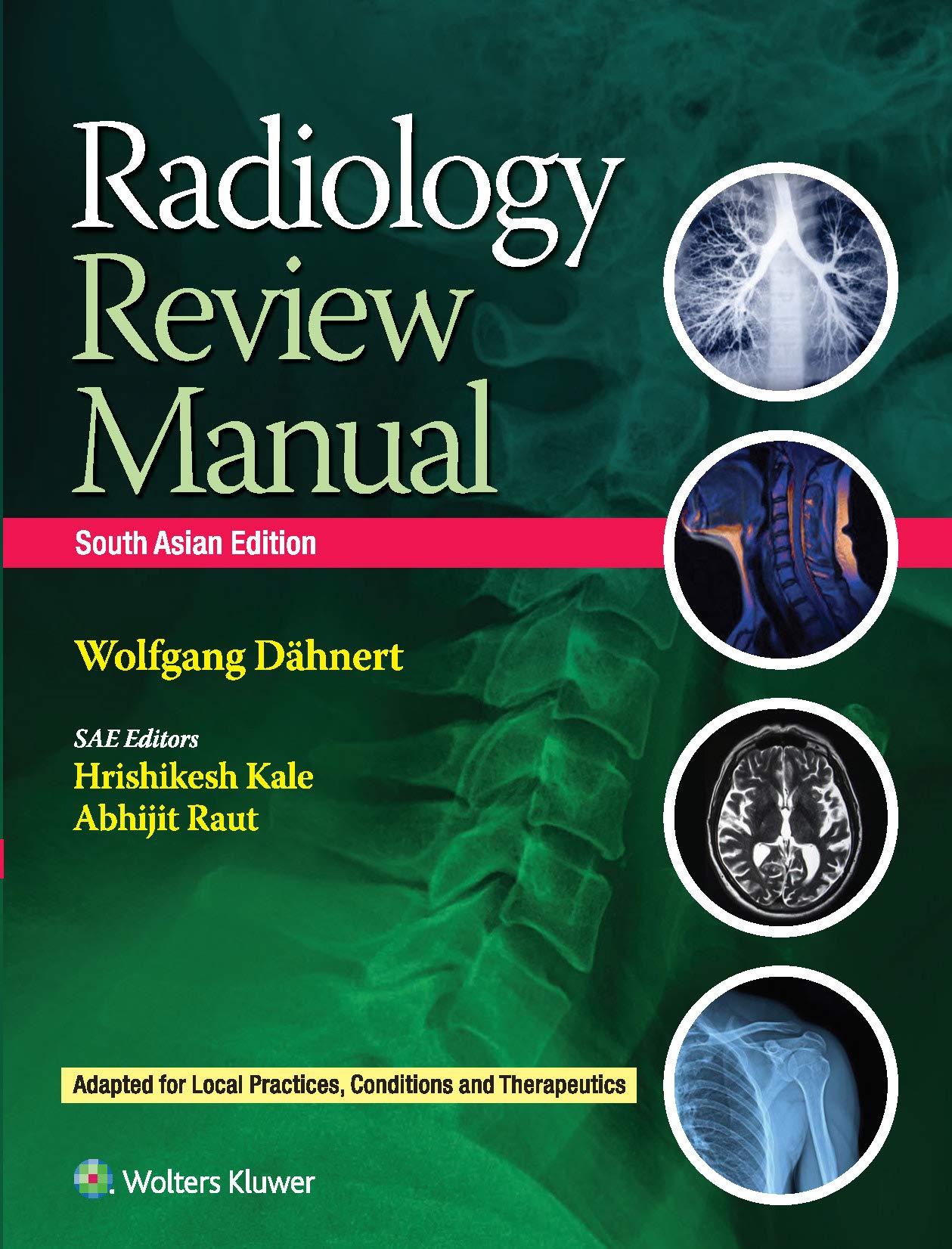 Radiology Review Manual (Sae) (Pb 2021)
