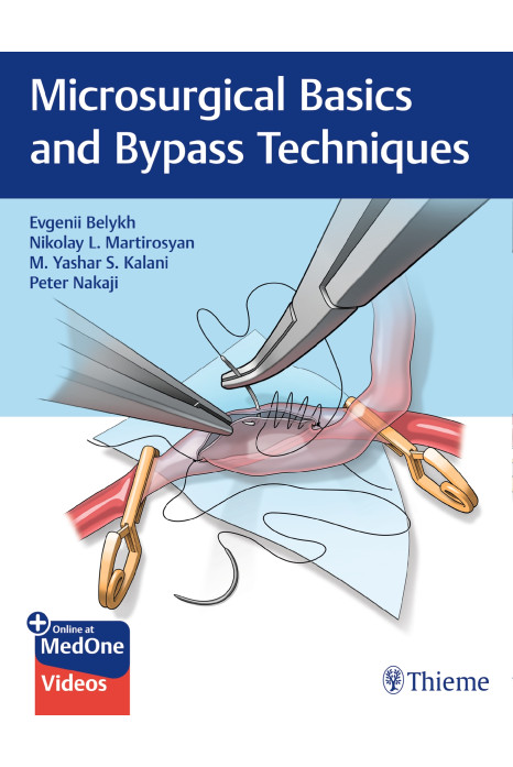Microsurgical Basics and Bypass Techniques 1st Edition 2020