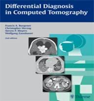 DIFFERENTIAL DIAGNOSIS IN COMPUTED TOMOGRAPHY (Ind