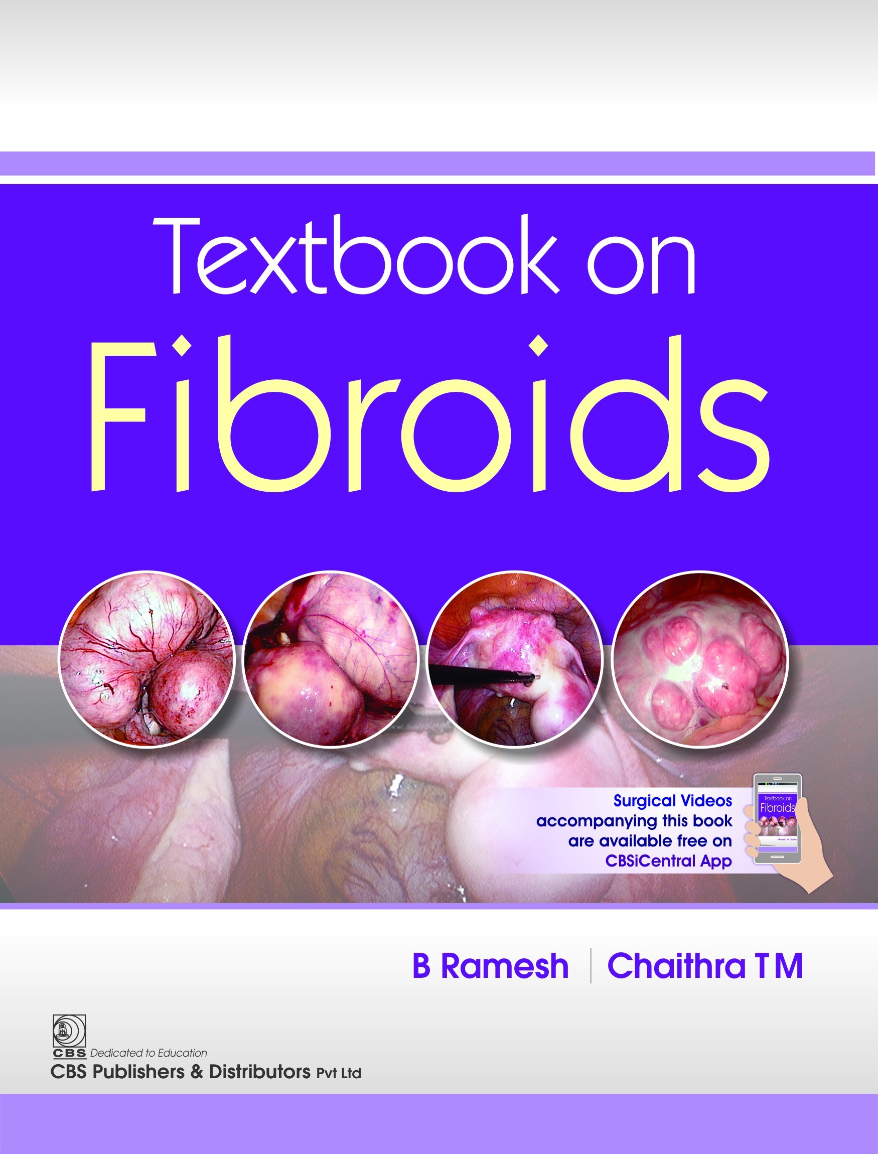 Textbook On Fibroids (Pb 2018)