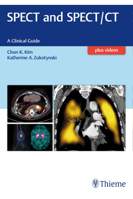 Spect And Spect/Ct A Clinical Guide