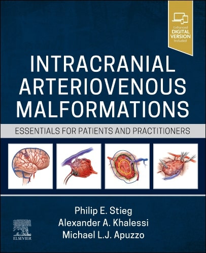 Intracranial arteriovenous malformations essentials for patients and practitioners with access code (hb 2024)